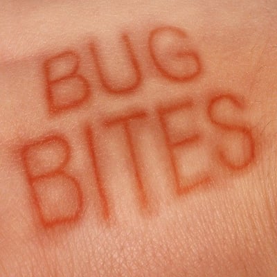 6 Tips for a Safe Bug Season in Your Homeowners Association-featured